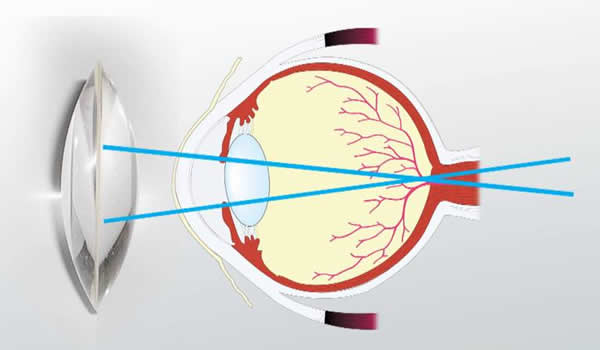平面镜、球面镜、透镜成像雾里看花 记住这个表格 光学成像一点通! 第2张